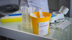 Vědci z UP přišli s rychlejší metodou testování na koronavirus